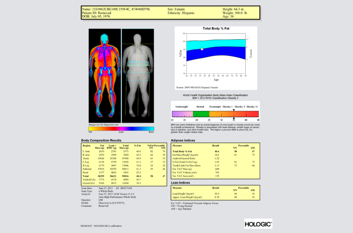 graphic of x-rays and measurment data in tables.
